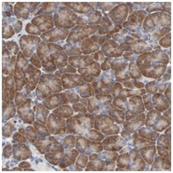 DHRSX, Rabbit, Polyclonal Antibody, Abnova 100 &mu;L | Buy Online | Abnova Corporation | Fisher Scientific