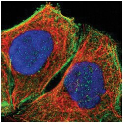 DHRSX, Rabbit, Polyclonal Antibody, Abnova 100 &mu;L | Buy Online | Abnova Corporation | Fisher Scientific