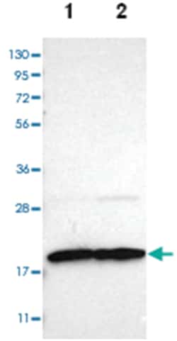 TOMM22, Rabbit, Polyclonal Antibody, Abnova 100&mu;L; Unlabeled:Antibodies,