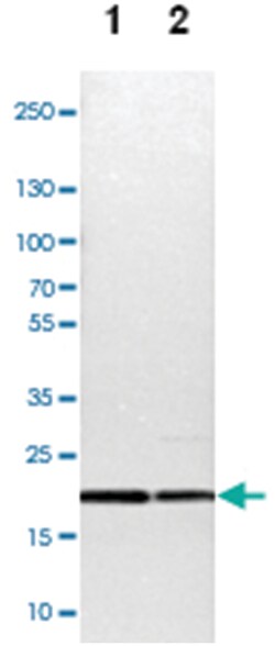 TOMM22, Rabbit, Polyclonal Antibody, Abnova 100&mu;L; Unlabeled:Antibodies,