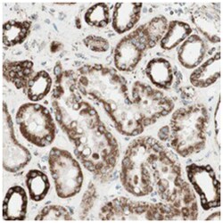 TOMM22, Rabbit, Polyclonal Antibody, Abnova 100&mu;L; Unlabeled:Antibodies,