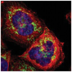 TOMM22, Rabbit, Polyclonal Antibody, Abnova 100&mu;L; Unlabeled:Antibodies,