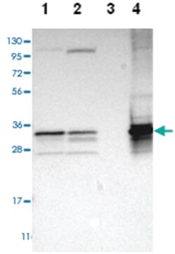 TST, Rabbit, Polyclonal Antibody, Abnova 100 &mu;L | Buy Online | Abnova Corporation | Fisher Scientific