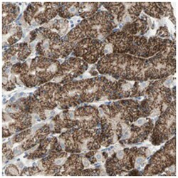 TST, Rabbit, Polyclonal Antibody, Abnova 100 &mu;L | Buy Online | Abnova Corporation | Fisher Scientific