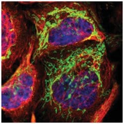 TST, Rabbit, Polyclonal Antibody, Abnova 100 &mu;L | Buy Online | Abnova Corporation | Fisher Scientific