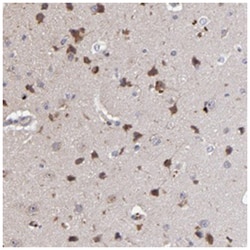 MAGEE1, Rabbit, Polyclonal Antibody, Abnova 100&mu;L; Unlabeled:Antibodies,