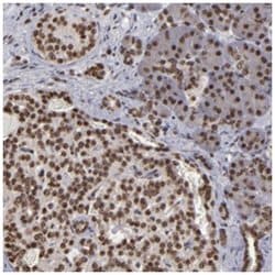 CSDC2, Rabbit, Polyclonal Antibody, Abnova 100 &mu;L | Buy Online | Abnova Corporation | Fisher Scientific