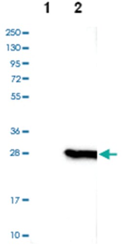 CSDC2, Rabbit, Polyclonal Antibody, Abnova 100 &mu;L | Buy Online | Abnova Corporation | Fisher Scientific