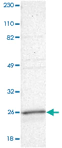 RAB9A, Rabbit, Polyclonal Antibody, Abnova 100 &mu;L | Buy Online | Abnova | Fisher Scientific