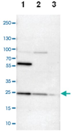 RAB9A, Rabbit, Polyclonal Antibody, Abnova 100 &mu;L | Buy Online | Abnova | Fisher Scientific