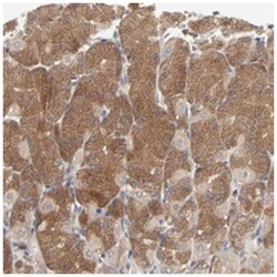 RAB9A, Rabbit, Polyclonal Antibody, Abnova 100 &mu;L | Buy Online | Abnova | Fisher Scientific