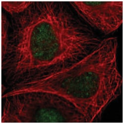 ABL2 Rabbit anti-Human, Polyclonal Antibody, Abnova 100 &mu;L | Buy Online | Abnova Corporation | Fisher Scientific