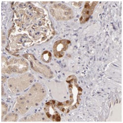 SH2D4A Rabbit anti-Human, Polyclonal Antibody, Abnova 100 &mu;L | Buy Online | Abnova Corporation | Fisher Scientific