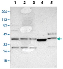 LRG1 Rabbit anti-Human, Polyclonal Antibody, Abnova 100 &mu;L | Buy Online | Abnova Corporation | Fisher Scientific