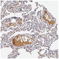 LRG1 Rabbit anti-Human, Polyclonal Antibody, Abnova 100 &mu;L | Buy Online | Abnova Corporation | Fisher Scientific