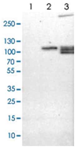RAP1GAP, Rabbit, Polyclonal Antibody, Abnova 100 &mu;L | Buy Online | Abnova Corporation | Fisher Scientific