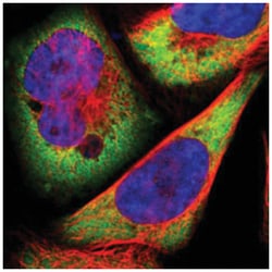 USP51, Rabbit, Polyclonal Antibody, Abnova 100 &mu;L | Buy Online | Abnova Corporation | Fisher Scientific