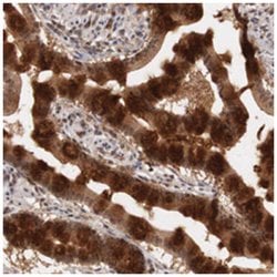PLEKHA1, Rabbit, Polyclonal Antibody, Abnova 100 &mu;L | Buy Online | Abnova Corporation | Fisher Scientific