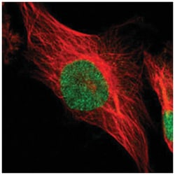 PSMC4, Rabbit, Polyclonal Antibody, Abnova 100&mu;L; Unlabeled:Antibodies,