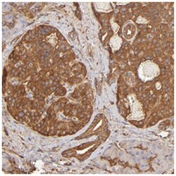 DPYSL2 Rabbit anti-Human, Mouse, Rat, Polyclonal Antibody, Abnova 100 &mu;L | Buy Online | Abnova Corporation | Fisher Scientific