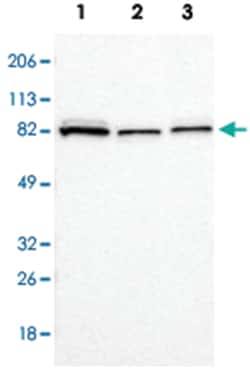 CARS Rabbit anti-Human, Mouse, Rat, Polyclonal Antibody, Abnova 100&mu;L;