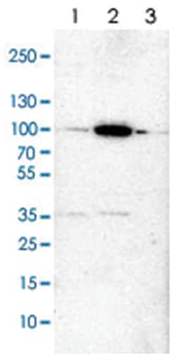 CARS Rabbit anti-Human, Mouse, Rat, Polyclonal Antibody, Abnova 100&mu;L;