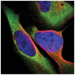 CARS Rabbit anti-Human, Mouse, Rat, Polyclonal Antibody, Abnova 100&mu;L;