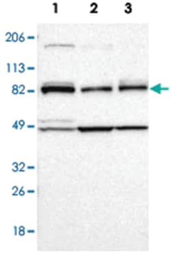 CARS Rabbit anti-Human, Polyclonal Antibody, Abnova 100&mu;L; Unlabeled:Antibodies,
