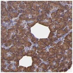 CARS Rabbit anti-Human, Polyclonal Antibody, Abnova 100&mu;L; Unlabeled:Antibodies,