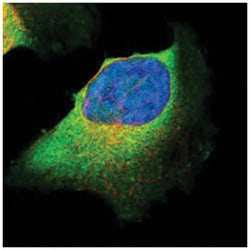 CARS Rabbit anti-Human, Polyclonal Antibody, Abnova 100&mu;L; Unlabeled:Antibodies,