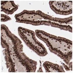 SNW1 Rabbit anti-Human, Mouse, Rat, Polyclonal Antibody, Abnova 100&mu;L;