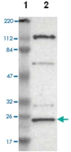 GCET2, Rabbit, Polyclonal Antibody, Abnova 100 &mu;L | Buy Online | Abnova Corporation | Fisher Scientific