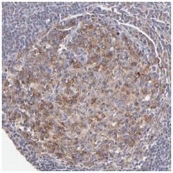 GCET2, Rabbit, Polyclonal Antibody, Abnova 100 &mu;L | Buy Online | Abnova Corporation | Fisher Scientific