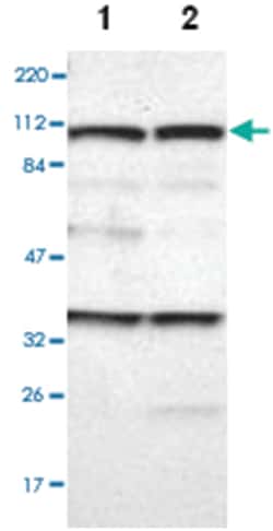 SND1 Rabbit anti-Human, Mouse, Rat, Polyclonal Antibody, Abnova 100&mu;L;