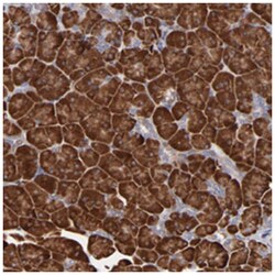 SND1 Rabbit anti-Human, Mouse, Rat, Polyclonal Antibody, Abnova 100&mu;L;