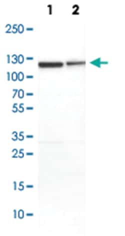 SND1 Rabbit anti-Human, Mouse, Rat, Polyclonal Antibody, Abnova 100&mu;L;