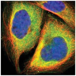 SND1 Rabbit anti-Human, Mouse, Rat, Polyclonal Antibody, Abnova 100&mu;L;