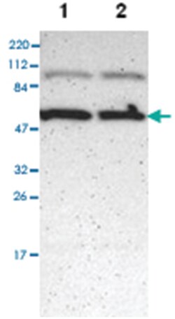 RNASEL, Rabbit, Polyclonal Antibody, Abnova 100&mu;L; Unlabeled:Antibodies,
