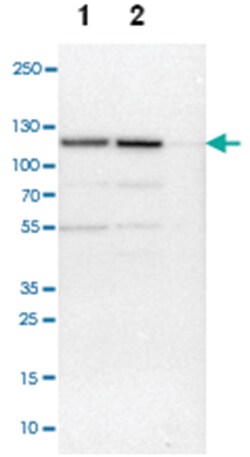 NCAPH, subunit H, Rabbit, Polyclonal Antibody, Abnova 100&mu;L; Unlabeled:Antibodies,
