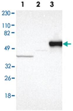 SERPINA7 Rabbit anti-Human, Polyclonal Antibody, Abnova 100&mu;L; Unlabeled:Antibodies,