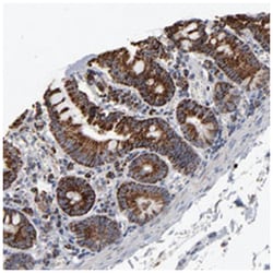 UQCRC1, Rabbit, Polyclonal Antibody, Abnova 100&mu;L; Unlabeled:Antibodies,