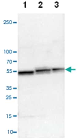 UQCRC1, Rabbit, Polyclonal Antibody, Abnova 100&mu;L; Unlabeled:Antibodies,
