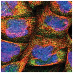 TROVE2, Rabbit, Polyclonal Antibody, Abnova 100&mu;L; Unlabeled:Antibodies,