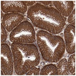 RPS6KA6 Rabbit anti-Human, Polyclonal Antibody, Abnova 100&mu;L; Unlabeled:Antibodies,