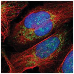 RPS6KA6 Rabbit anti-Human, Polyclonal Antibody, Abnova 100&mu;L; Unlabeled:Antibodies,