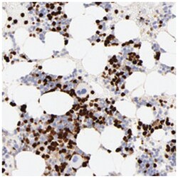 S100A12 Rabbit anti-Human, Polyclonal Antibody, Abnova 100&mu;L; Unlabeled:Antibodies,
