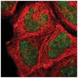 S100A12 Rabbit anti-Human, Polyclonal Antibody, Abnova 100&mu;L; Unlabeled:Antibodies,