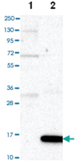 S100A12 Rabbit anti-Human, Polyclonal Antibody, Abnova 100&mu;L; Unlabeled:Antibodies,