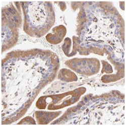 BGN, Rabbit, Polyclonal Antibody, Abnova 100&mu;L; Unlabeled:Antibodies,