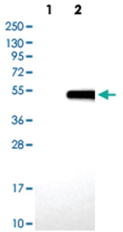 BGN, Rabbit, Polyclonal Antibody, Abnova 100&mu;L; Unlabeled:Antibodies,
